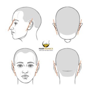Hair Condition Example